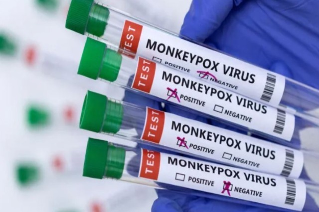 Kosova has confirmed its first case of M pox