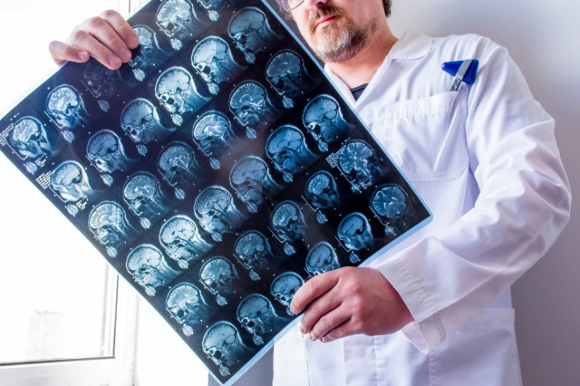 Disa nga sëmundjet që mjekët shpesh i diagnostikojnë gabimisht