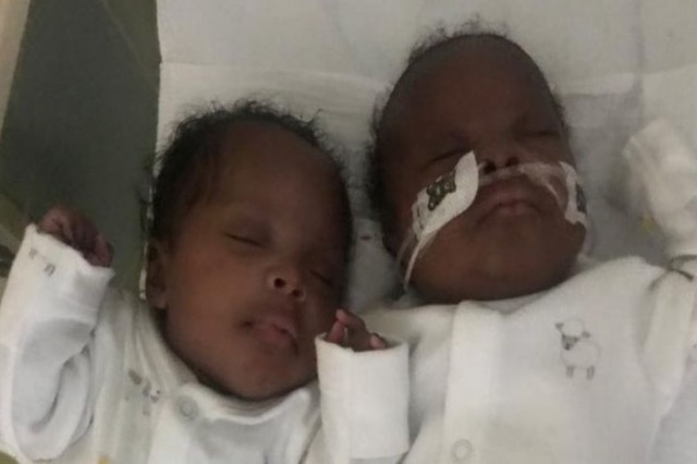 Një paciente me covid-19 sjell në jetë binjakët, ndërsa vetë ishte në koma