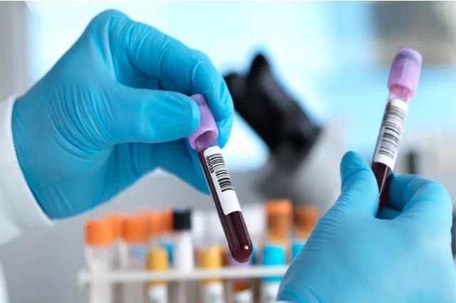 Studimi, një test gjaku do të identifikojë më shumë se 50 lloje të kancerit