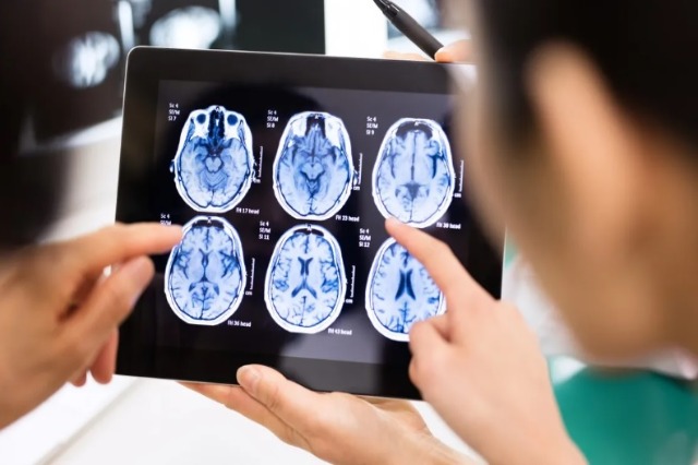 Ilaçi eksperimental i Alzheimerit ngadalëson simptomat, dritë jeshile kundër sëmundjes