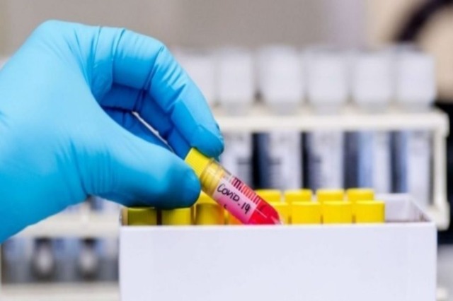 Maqedonia e Veriut regjistron 30 viktima me koronavirus