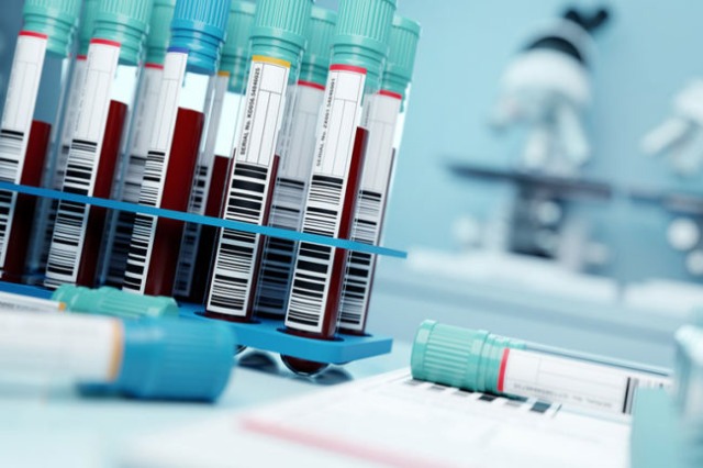 Një test i ri gjaku  mund të zbulojë rreth 14 lloje kanceri