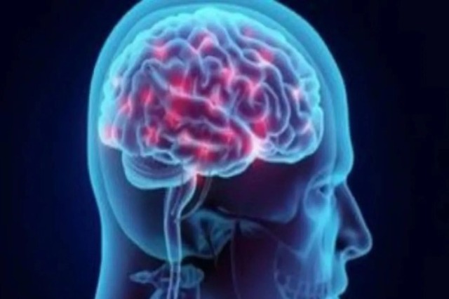 Studimi: Kafeina mund të jetë një trajtim i ardhshëm për sëmundjen e Alzheimerit