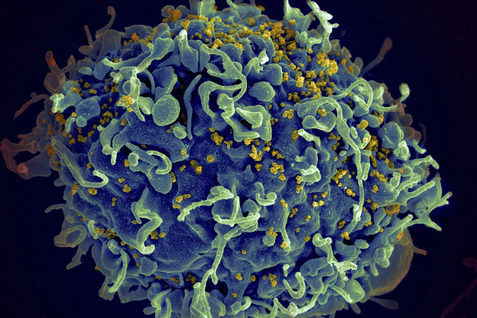 Revolucion në luftën kundër HIV-it, BE-ja miraton injektuesin dymujor që mund të ndalojë transmetimin e virusit
