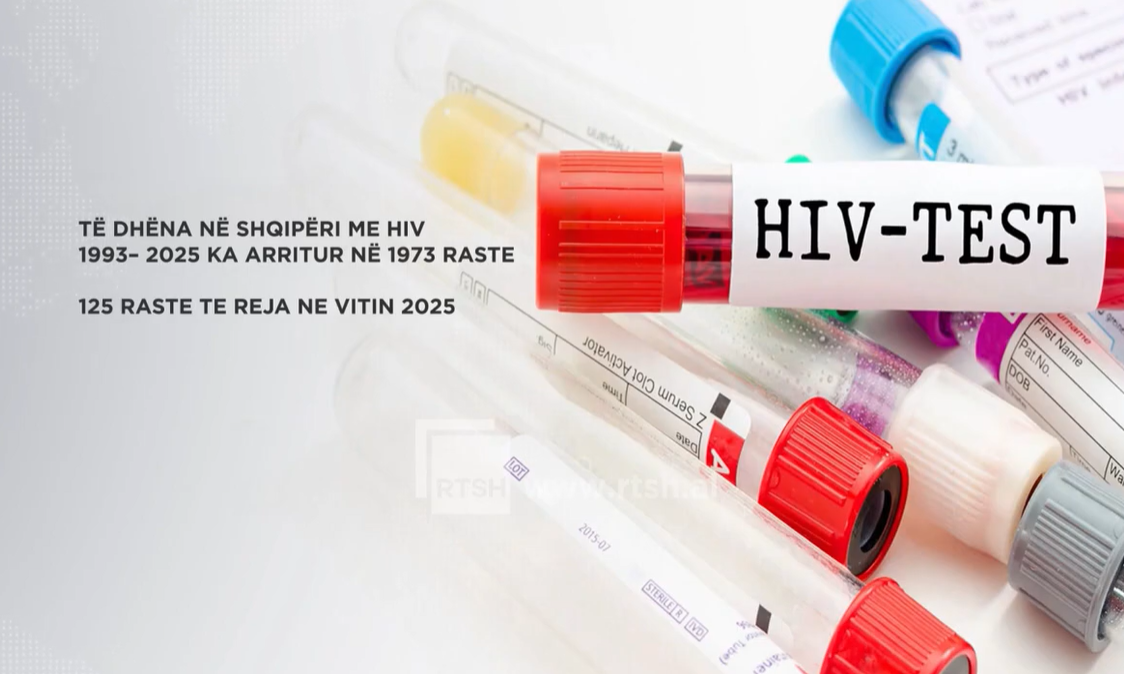 ISHP: 125 raste të reja me HIV në 2025, më të prekur meshkujt dhe ...