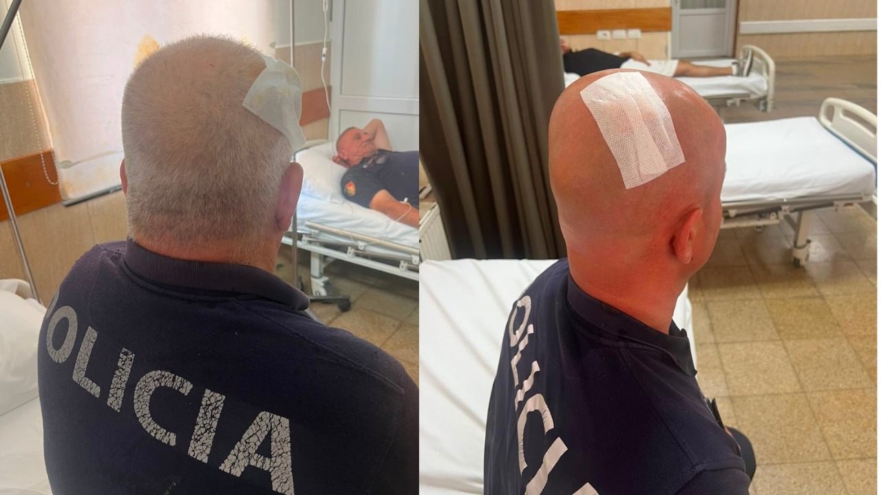 Përplasje para Kuvendit, plagosen gjashtë efektivë policie, dërgohen në Spitalin e Traumës