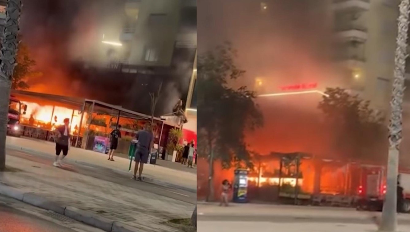 Zjarri në hotelin në Vlorë, 25-vjeçarja me djegie të rënda dërgohet për trajtim në Turqi. Shpenzimet mbulohen nga shteti shqiptar