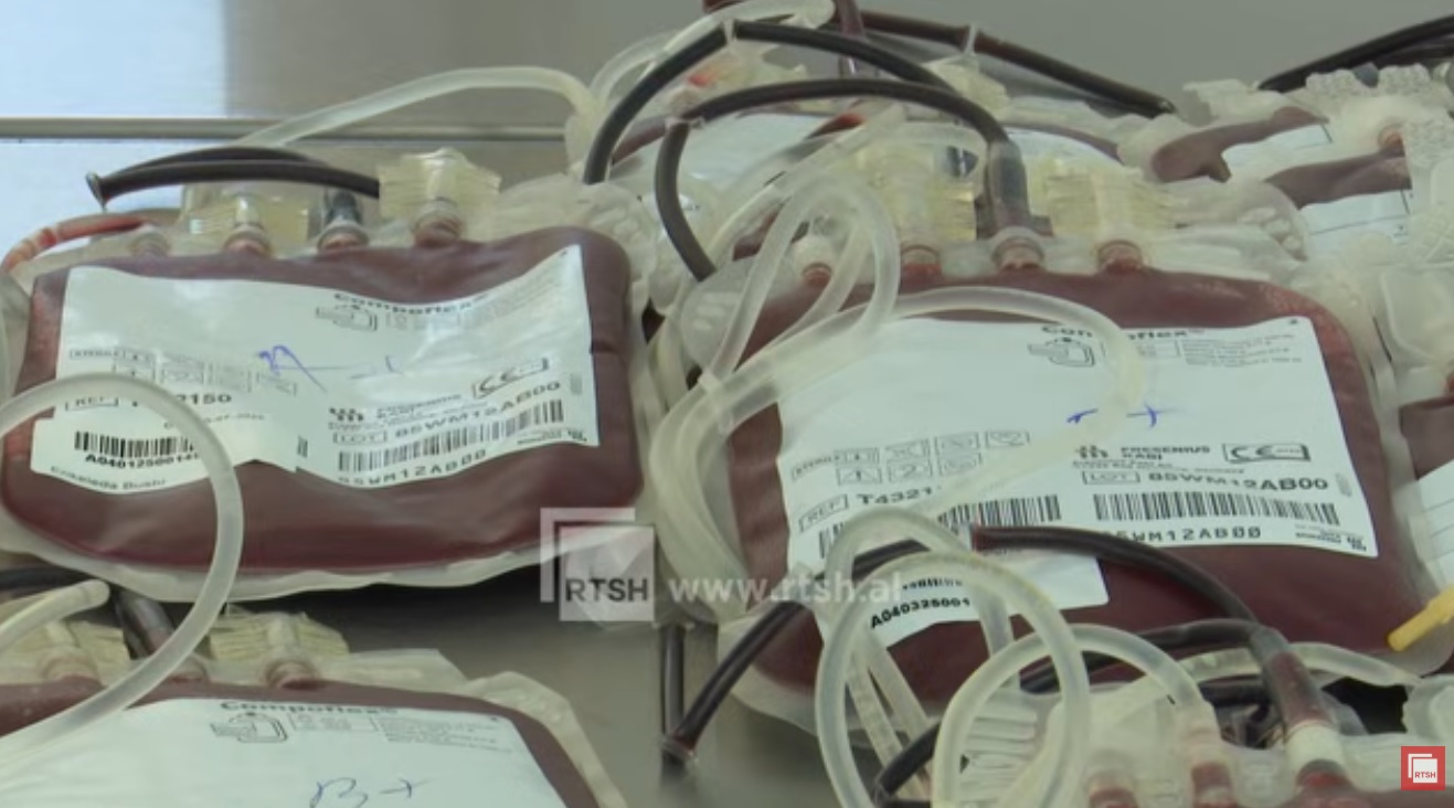 Kanceri i gjakut, rastet janë në rritje, Ivanaj: 55 raste të reja në vit. Mjekët thirrje për diagnozë që nis nga mjeku dhe jo laboratori